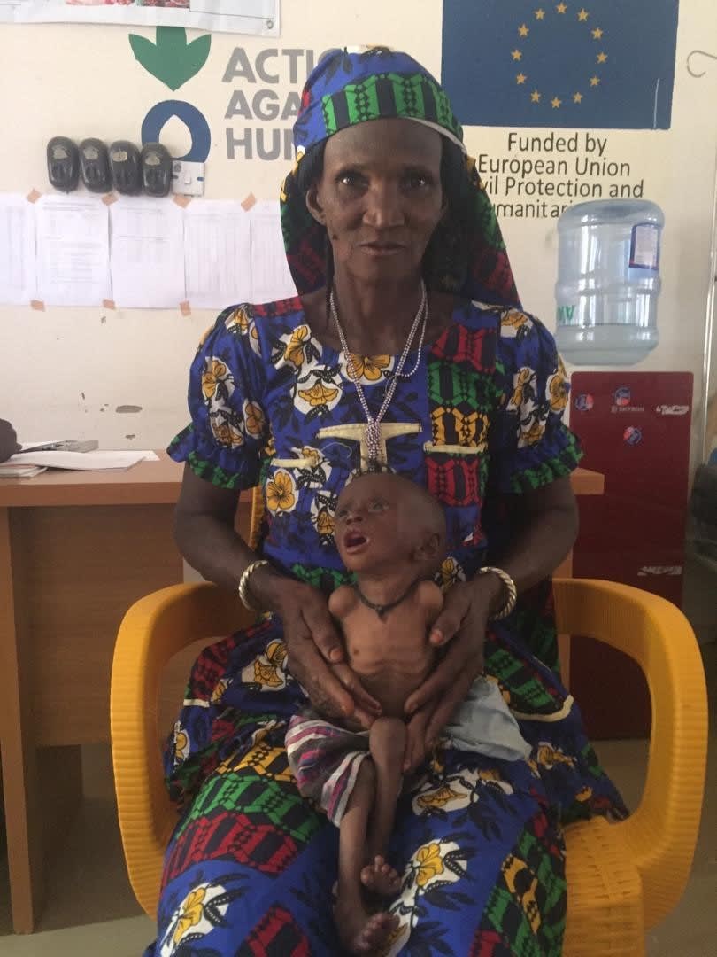 Nigéria Adam malnutrition